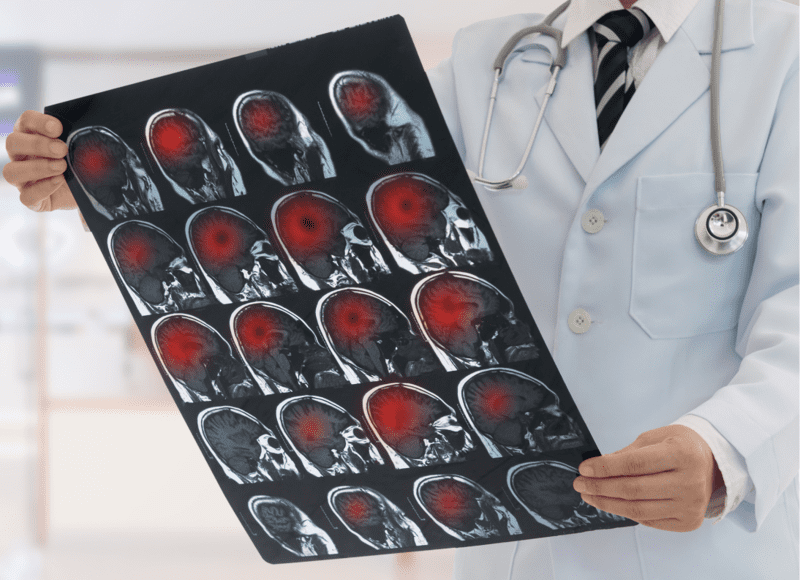 medico